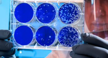 Culture Media Antibiotics To Prevent Infectious Bacteria
